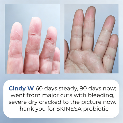 Skinesa Skin Probiotic 30 Servings